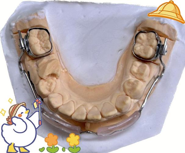下颌正畸基托制作视频-图2