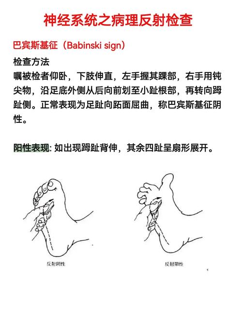 Tweed测量方法在正畸诊断中的核心指标有哪些?不同面部类型下如何优化其测量准确性?-图1 Tweed测量方法在正畸诊断中的核心指标有哪些?不同面部类型下如何优化其测量准确性?-图1