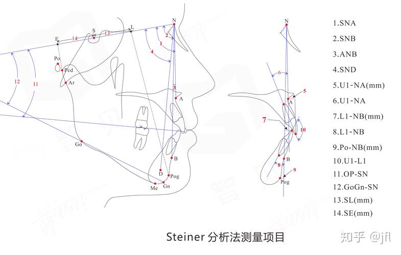 Tweed测量方法在正畸诊断中的核心指标有哪些?不同面部类型下如何优化其测量准确性?-图3 Tweed测量方法在正畸诊断中的核心指标有哪些?不同面部类型下如何优化其测量准确性?-图3