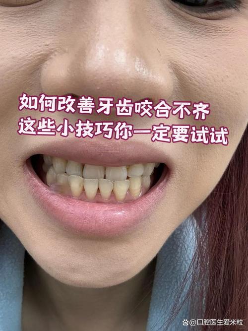 咬合不齐有哪些常见治疗方法?不同矫正方式适合哪些人群?效果如何及需要注意什么?-图1 咬合不齐有哪些常见治疗方法?不同矫正方式适合哪些人群?效果如何及需要注意什么?-图1