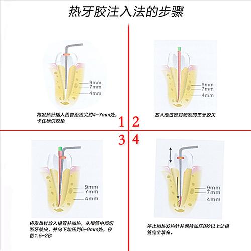 口腔牙胶尖消毒方法有哪些常见选择?不同消毒方式对材料性能及临床疗效有何影响?-图2 口腔牙胶尖消毒方法有哪些常见选择?不同消毒方式对材料性能及临床疗效有何影响?-图2