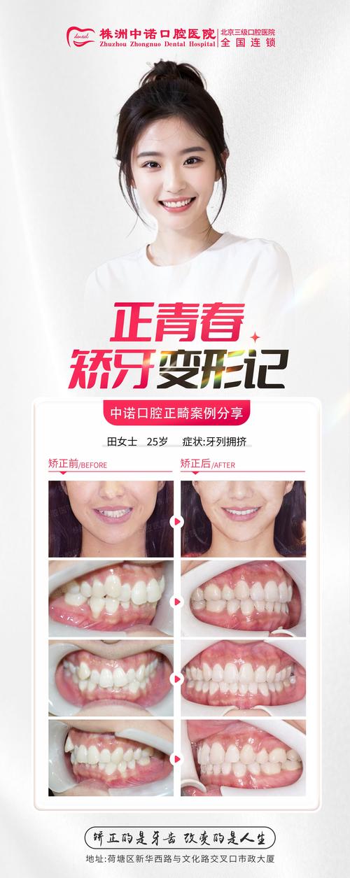 正畸治疗如何通过牙齿排列改善面部美学?其与微笑设计的关联又该如何精准把握?-图1 正畸治疗如何通过牙齿排列改善面部美学?其与微笑设计的关联又该如何精准把握?-图1