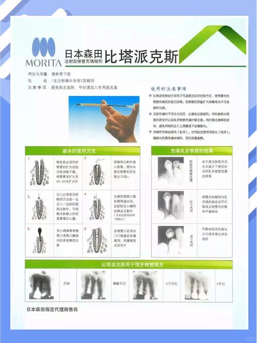 Vitapex方法在复杂根管治疗中的有效性如何？其适用范围与潜在并发症有哪些？-图1