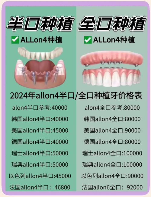 济南种植牙价格差异大吗？具体费用受哪些因素影响？包含哪些项目？-图2