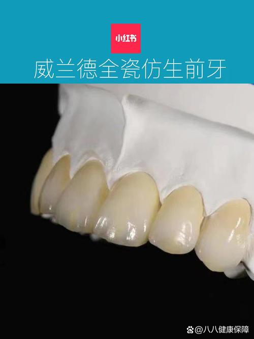 德国种牙品牌怎么选?不同技术、口碑和性价比的牌子哪个更适合你的口腔需求?-图1 德国种牙品牌怎么选?不同技术、口碑和性价比的牌子哪个更适合你的口腔需求?-图1