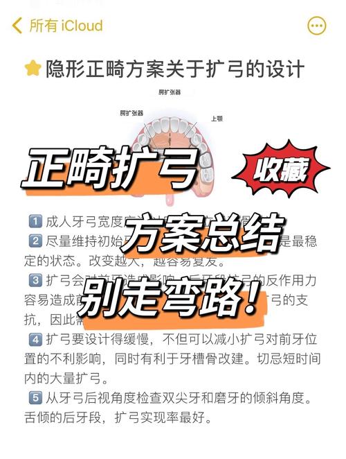 口腔正畸扩大牙弓有哪些常用技术?不同方法的原理、适应症及效果差异如何?-图2 口腔正畸扩大牙弓有哪些常用技术?不同方法的原理、适应症及效果差异如何?-图2