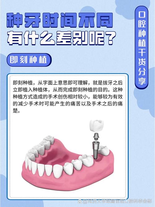 拔掉牙后到底要等多久才能种牙?最佳时间受哪些因素影响?-图2 拔掉牙后到底要等多久才能种牙?最佳时间受哪些因素影响?-图2