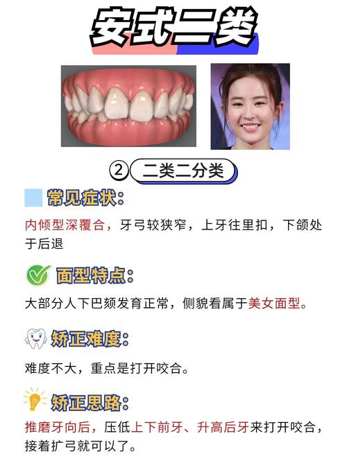 牙齿矫正常见方法有哪些?传统托槽、隐形矫正、舌侧矫正等不同方式分别适合哪些人群,各有哪些优缺点?-图2 牙齿矫正常见方法有哪些?传统托槽、隐形矫正、舌侧矫正等不同方式分别适合哪些人群,各有哪些优缺点?-图2