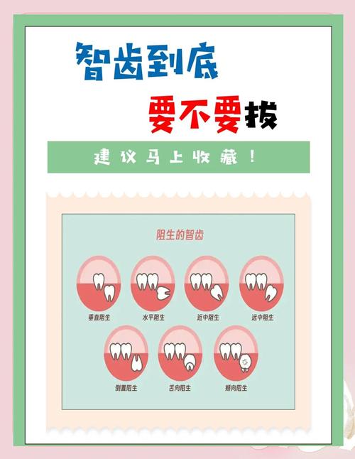 智齿蛀牙后,治疗方法和普通蛀牙有何区别?不同严重程度下如何选择拔牙或保牙方案?-图1 智齿蛀牙后,治疗方法和普通蛀牙有何区别?不同严重程度下如何选择拔牙或保牙方案?-图1