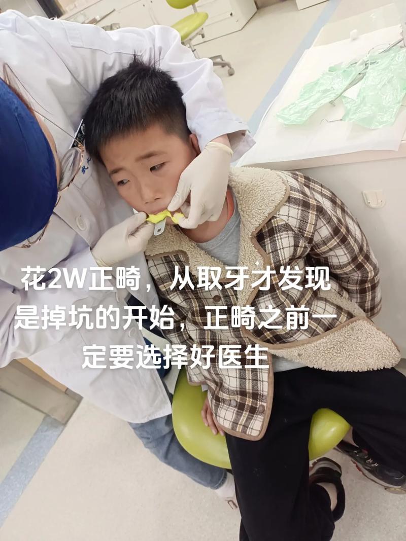 正畸医师为何不会主动告知这些潜在风险?效果、费用与后遗症,患者有权知道哪些被隐瞒的真相?-图2 正畸医师为何不会主动告知这些潜在风险?效果、费用与后遗症,患者有权知道哪些被隐瞒的真相?-图2