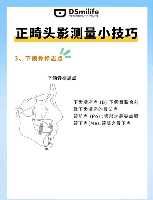 免费正畸头影测量软件的功能是否全面？其测量准确性和临床适用性如何保障？-图1