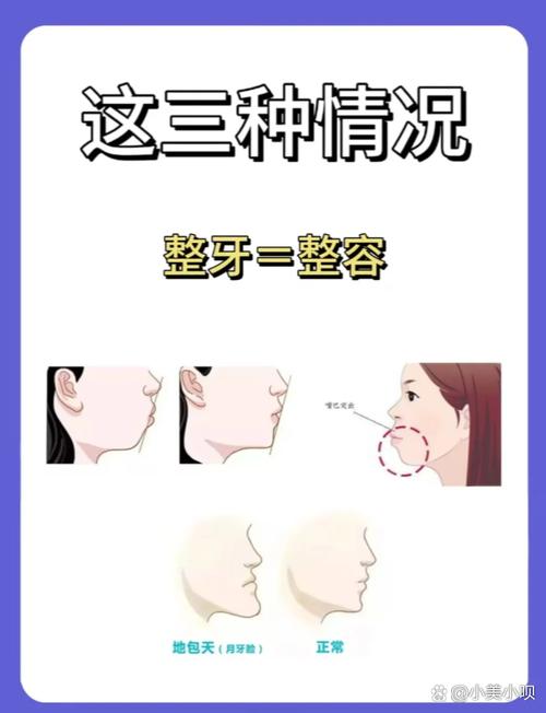 正畸治疗过程中下巴形态发生变化,究竟与牙齿移动的力学作用、骨骼改建机制还是肌肉功能调整相关?-图1 正畸治疗过程中下巴形态发生变化,究竟与牙齿移动的力学作用、骨骼改建机制还是肌肉功能调整相关?-图1