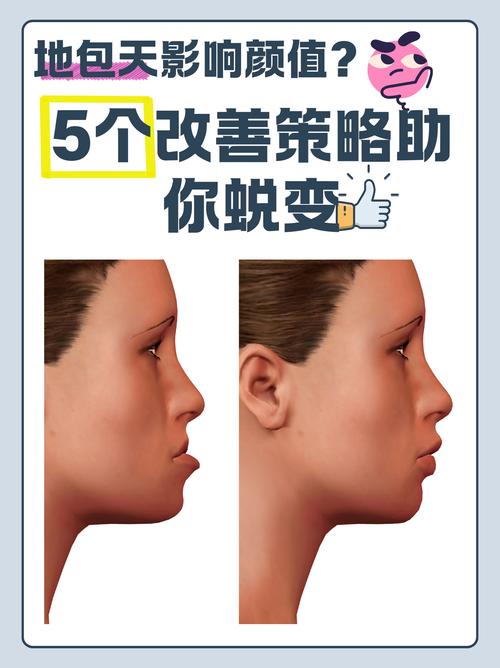 正畸治疗过程中下巴形态发生变化,究竟与牙齿移动的力学作用、骨骼改建机制还是肌肉功能调整相关?-图2 正畸治疗过程中下巴形态发生变化,究竟与牙齿移动的力学作用、骨骼改建机制还是肌肉功能调整相关?-图2