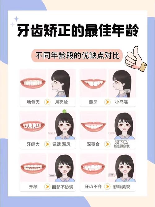 牙齿不齐的治疗方法-图2 牙齿不齐的治疗方法-图2