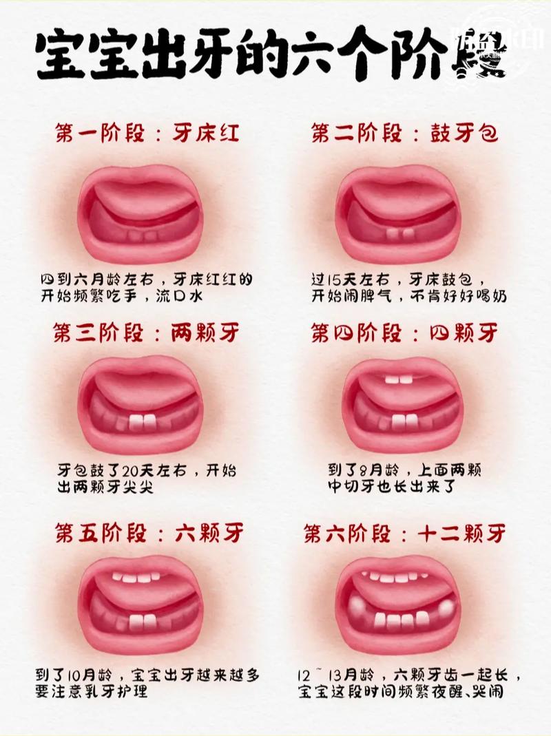 种牙后多久才能长出自然牙?影响因素有哪些?不同人群时间差异大吗?-图2 种牙后多久才能长出自然牙?影响因素有哪些?不同人群时间差异大吗?-图2