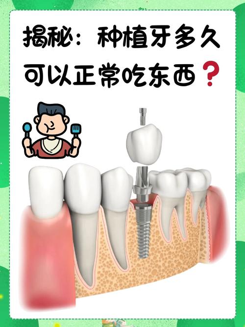 种牙后多久才能长出自然牙?影响因素有哪些?不同人群时间差异大吗?-图1 种牙后多久才能长出自然牙?影响因素有哪些?不同人群时间差异大吗?-图1