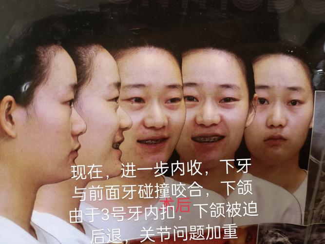 拜博口腔牙齿综合正畸效果真的靠谱吗？不同牙齿问题矫正周期差异大吗？价格透明吗？医生会根据个人情况定制方案吗？-图1