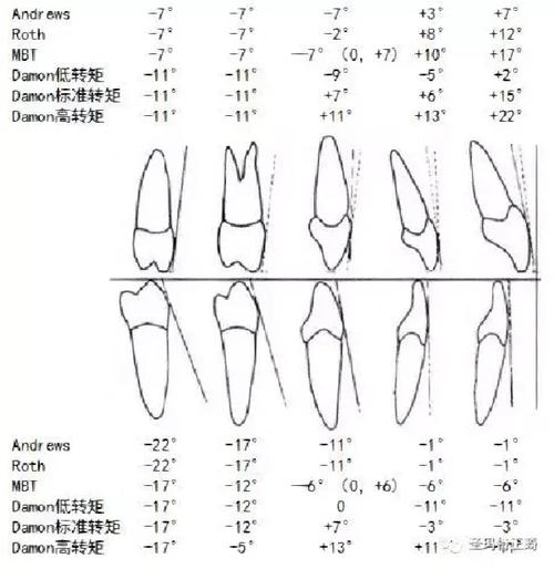 正畸打转矩到底是什么?为何这个操作能精准控制牙齿角度?看完讲解视频你就懂了!-图3 正畸打转矩到底是什么?为何这个操作能精准控制牙齿角度?看完讲解视频你就懂了!-图3