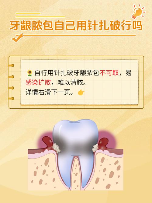治疗牙龈发炎有哪些有效方法？日常护理与专业治疗如何科学结合？-图1