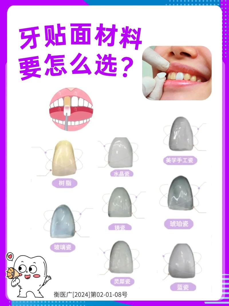 牙齿贴面预备方法的选择需考虑哪些因素？不同牙体条件下如何优化预备步骤以兼顾美观与牙体健康？-图3