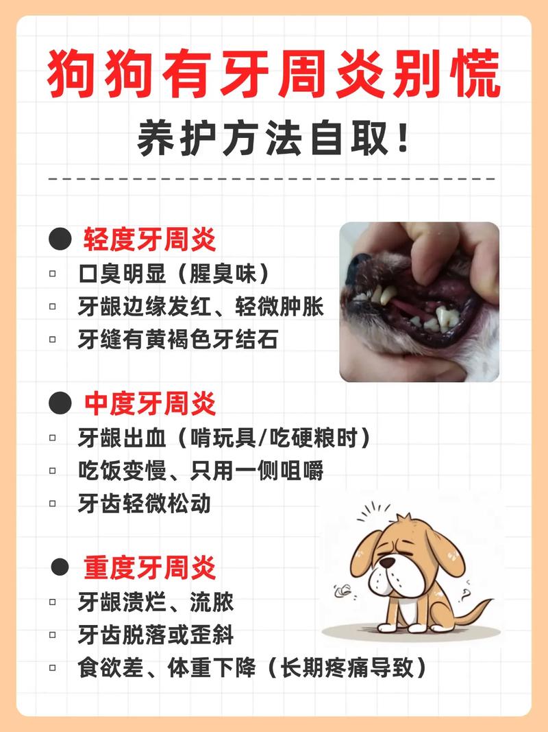 面对重度牙周炎，临床常用的治疗方法有哪些？如何根据患者具体情况制定个性化治疗方案？-图3