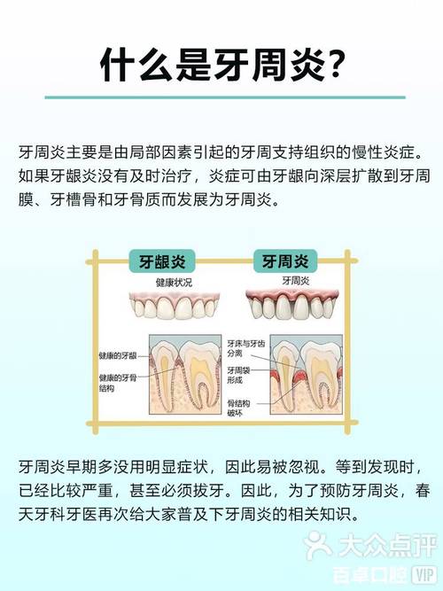 牙周炎的具体治疗方法有哪些?不同严重程度的患者该如何选择针对性方案?治疗期间有哪些注意事项需警惕?-图1 牙周炎的具体治疗方法有哪些?不同严重程度的患者该如何选择针对性方案?治疗期间有哪些注意事项需警惕?-图1