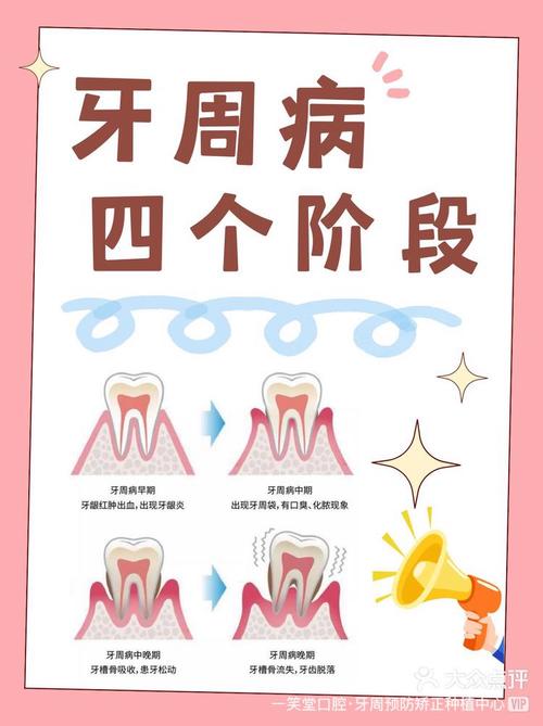 牙周炎的具体治疗方法有哪些？不同严重程度的患者该如何选择针对性方案？治疗期间有哪些注意事项需警惕？-图2