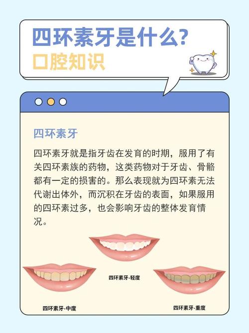 四环素牙齿美白方法有哪些？不同方法的效果如何，是否存在风险，又该如何科学选择？-图2