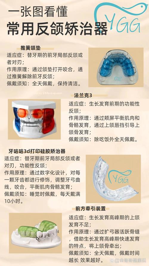 反颌矫正器的制作方法有哪些技术要点？不同反颌类型（如骨性、牙性）的定制方案有何差异？材料选择如何影响矫正效果与佩戴舒适度？-图1