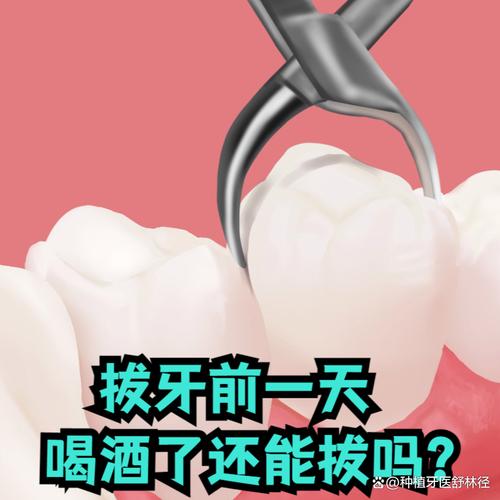 种牙前喝酒会影响手术效果和恢复吗？需要提前多久戒酒才安全？-图1