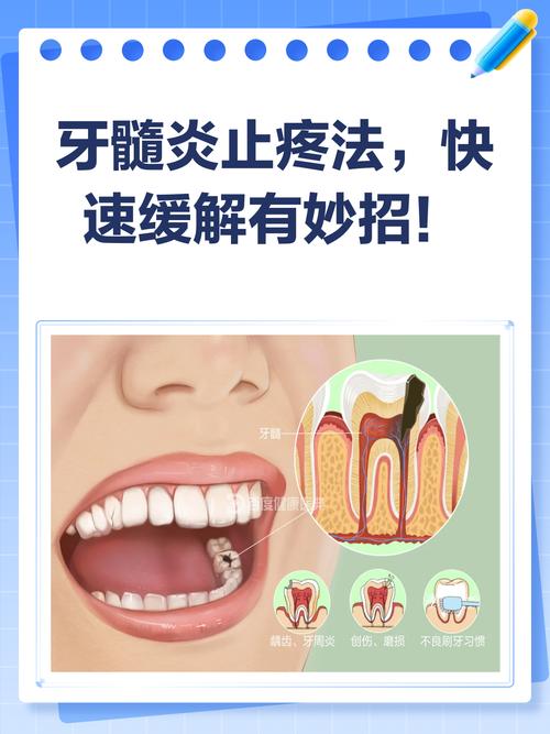 急性牙髓炎发作时疼痛难忍，有哪些快速有效的止痛方法？家庭应急处理和就医时机该如何把握？-图1
