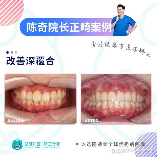 上海想做牙齿正畸，如何找到技术好、价格透明且医生经验丰富的靠谱机构？-图1