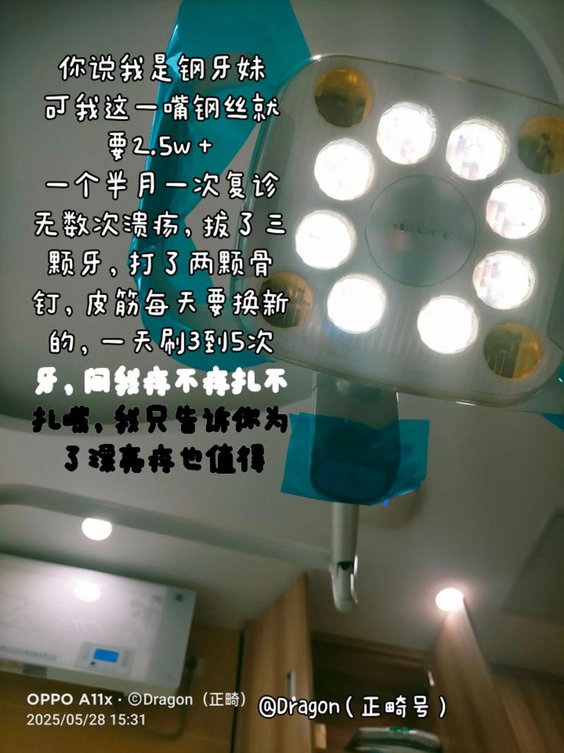 中山附属口腔医院正畸效果如何？不同错颌畸形适合哪些矫正技术？价格和周期大概是多少？-图1