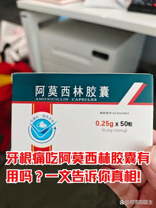 种牙后吃什么消炎药合适？术后恢复期如何选药？吃多久才有效？要注意哪些禁忌？-图2