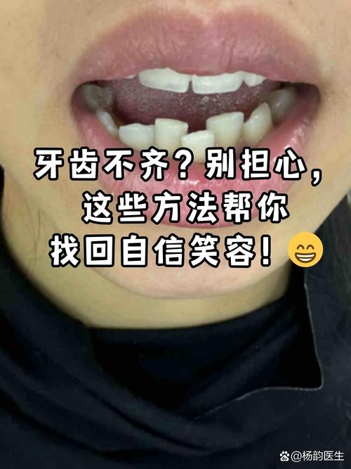 牙不齐有哪些矫正方法?传统牙套、隐形矫正等不同方式的优缺点和适用人群如何选择?-图1 牙不齐有哪些矫正方法?传统牙套、隐形矫正等不同方式的优缺点和适用人群如何选择?-图1