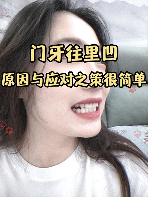 牙不齐有哪些矫正方法?传统牙套、隐形矫正等不同方式的优缺点和适用人群如何选择?-图3 牙不齐有哪些矫正方法?传统牙套、隐形矫正等不同方式的优缺点和适用人群如何选择?-图3