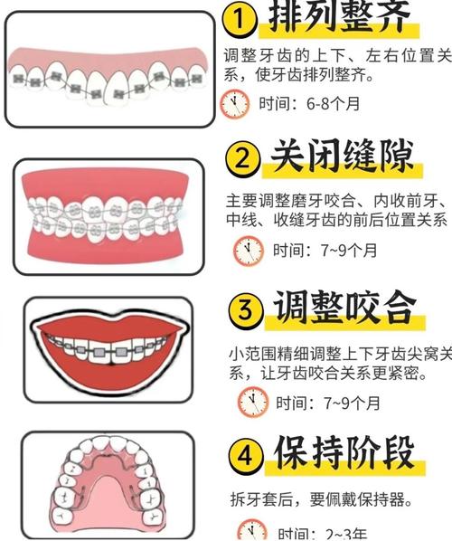 正畸牙齿矫正有哪些常见方法?不同矫正方式分别适合哪些牙齿问题及人群?-图3 正畸牙齿矫正有哪些常见方法?不同矫正方式分别适合哪些牙齿问题及人群?-图3