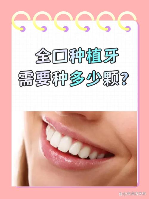 种植牙一次最多能种几棵？具体数量受哪些因素影响，是否需结合牙槽骨条件和医生评估？-图2