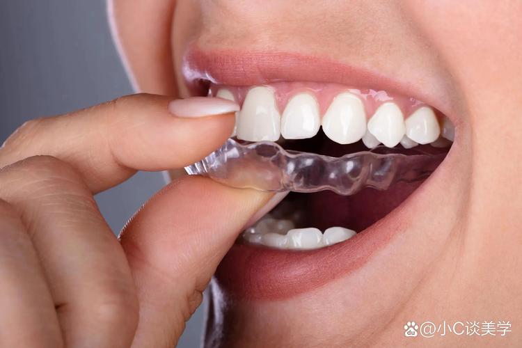 青少年牙齿矫正方法有哪些？不同年龄段适合哪种矫正方式？矫正期间需要注意哪些事项？-图2