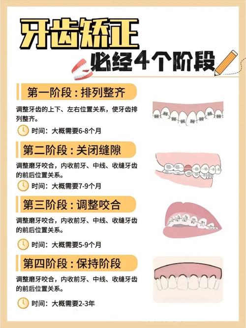 青少年牙齿矫正方法有哪些？不同年龄段适合哪种矫正方式？矫正期间需要注意哪些事项？-图1