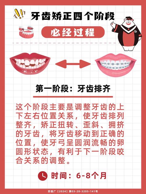 青少年牙齿矫正方法有哪些？不同年龄段适合哪种矫正方式？矫正期间需要注意哪些事项？-图3