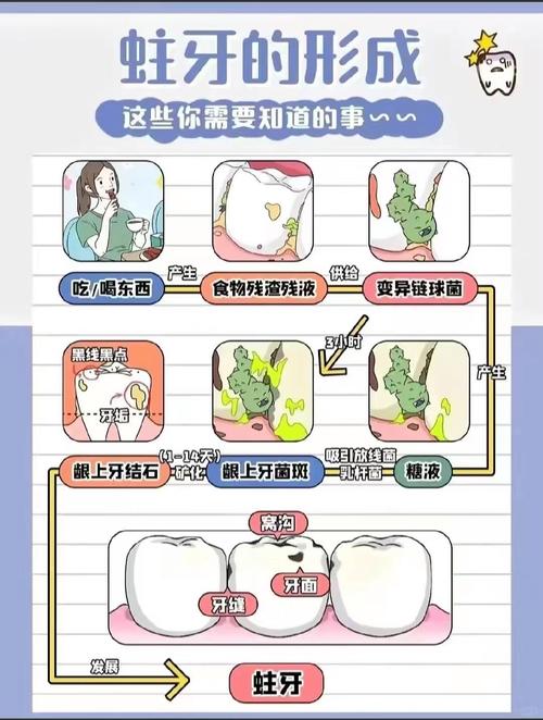 预防龋齿的有效方法有哪些？日常刷牙、饮食调整与专业涂氟如何协同作用？-图2