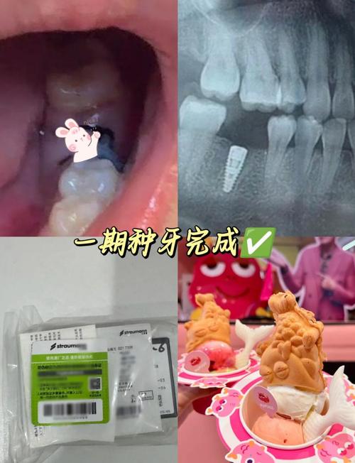 南京种牙哪里比较好？靠谱医院/医生怎么选？技术、价格和服务有哪些要注意的？-图2