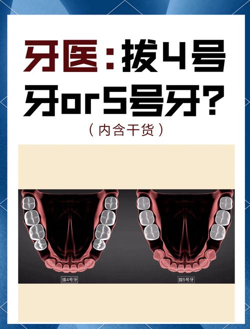 口腔正畸治疗是否包括拔智齿?拔智齿是正畸的必要环节吗?-图3 口腔正畸治疗是否包括拔智齿?拔智齿是正畸的必要环节吗?-图3
