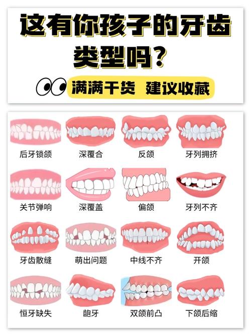 矫正牙齿的最佳方法是什么?传统托槽、隐形矫正、舌侧矫正等不同方式该如何选择?-图1 矫正牙齿的最佳方法是什么?传统托槽、隐形矫正、舌侧矫正等不同方式该如何选择?-图1