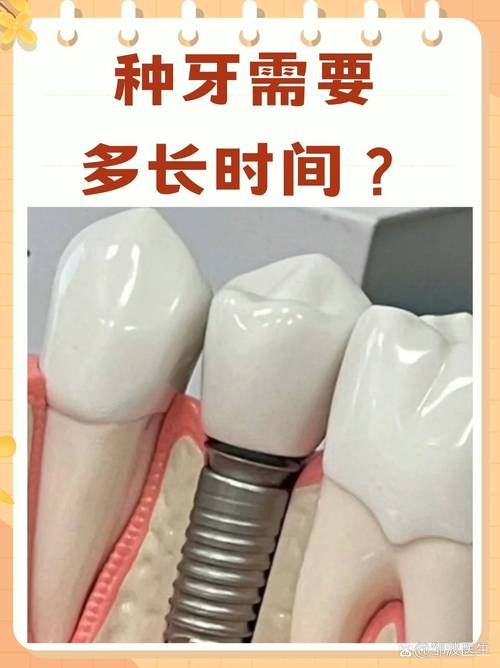 种牙真的好吗？效果媲美天然牙吗？能用多久？哪些因素决定种植牙寿命？-图3