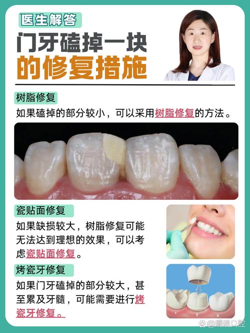 美容修复牙齿的方法有哪些？不同修复方式的效果、适用人群及安全性如何评估？-图1
