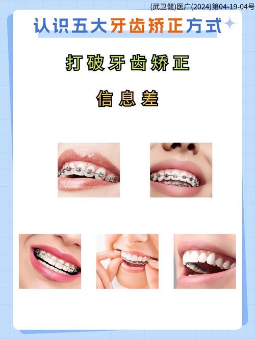 杭州龅牙矫正有哪些主流方法？传统金属、隐形矫正等不同方式的效果、费用和适应人群有何区别？-图2