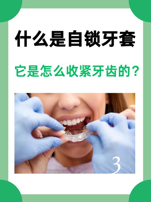 矫正牙齿有哪些常见方法?不同方法适合哪些人群,如何选择最适合自己的矫正方式?-图2 矫正牙齿有哪些常见方法?不同方法适合哪些人群,如何选择最适合自己的矫正方式?-图2