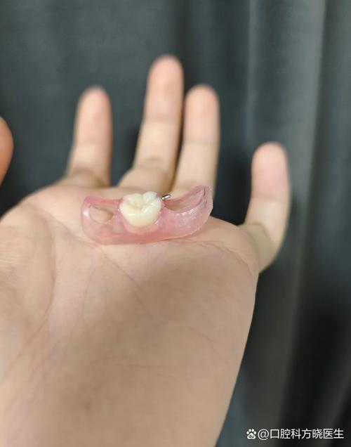 拔牙后若一直不种牙，邻牙真的会歪斜、牙槽骨会加速萎缩吗？对身体还有哪些隐藏影响？-图2